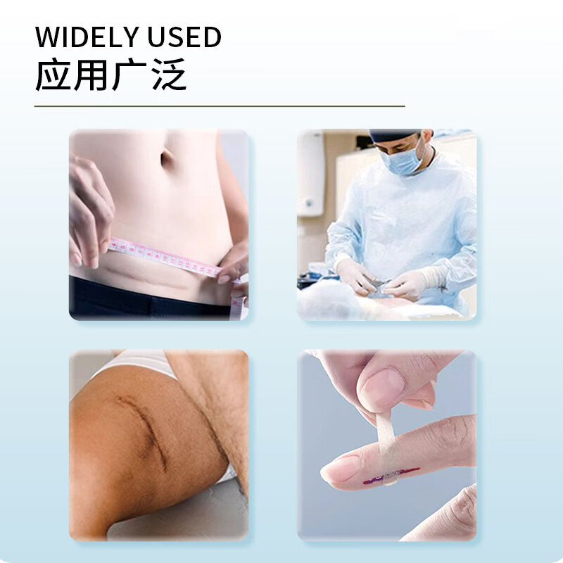 暨可复医用无敏透气胶带减张创面敷料免缝胶带胶布儿童孕妇通用术后祛疤 【单盒装】专利认证