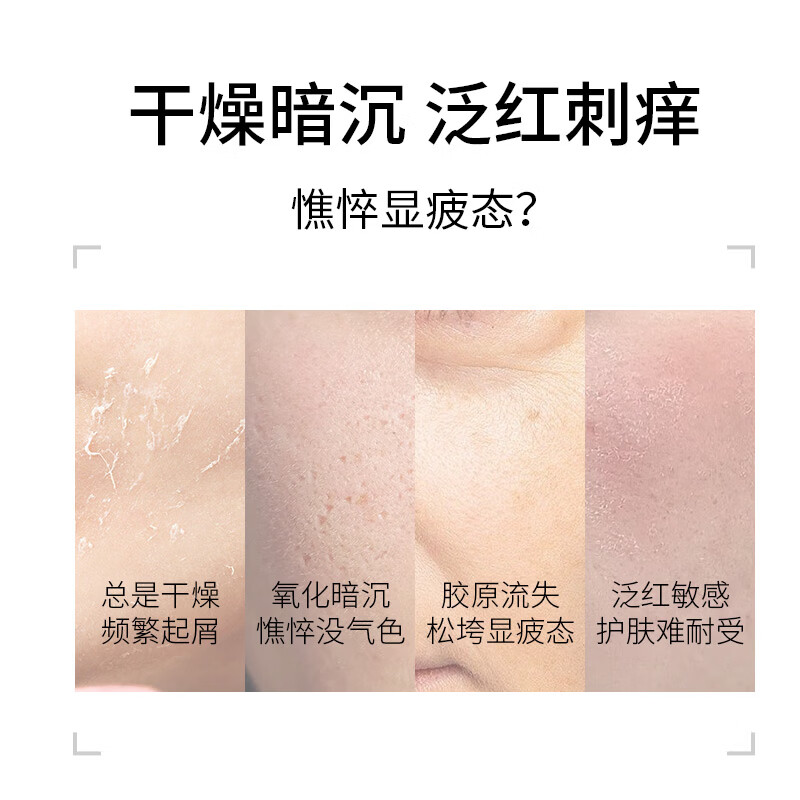珀芙研舒缓保湿修护霜敏感肌保湿滋润次抛精华液改善干燥泛红 【必囤】等渗10片+屏安面膜10片