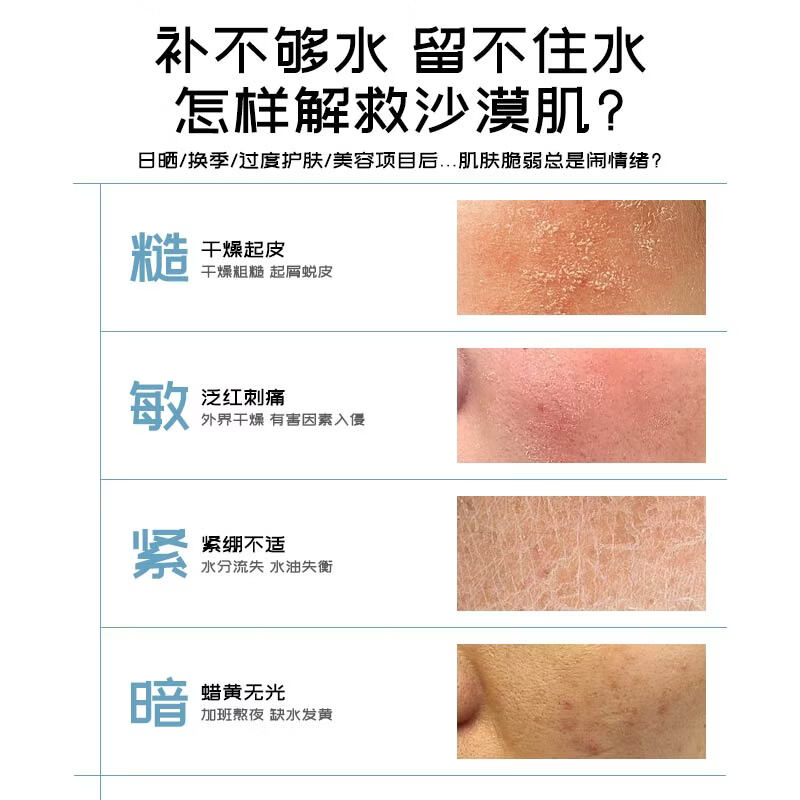 芕情雪莲花补水面膜礼物护肤品化妆品礼盒 面膜3盒15片