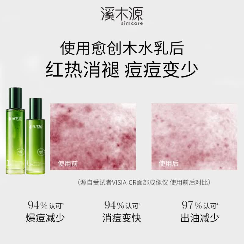 溪木源愈创木水乳套装抗痘油痘敏感肌控油修护抑痘礼物 【进阶祛痘】水+乳+精华15ml