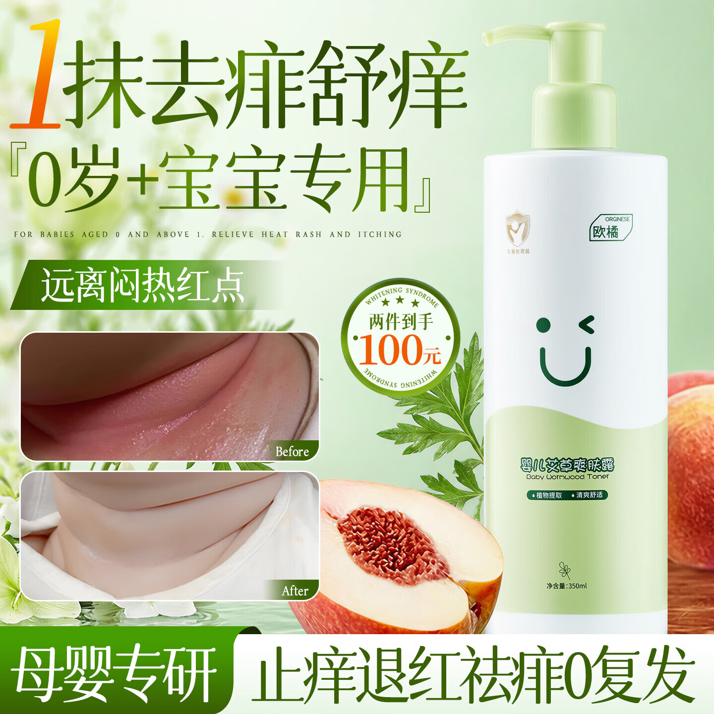 ORGINESE艾草痱子水爽身露婴儿爽身粉红脖子宝宝祛痱止痒儿童红屁屁350ml