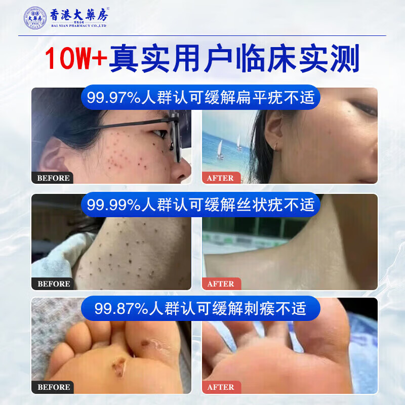 RSRDDY【一洗就掉】祛疣皂瘊尤皂猴子小肉粒痘痘粉刺清洁去尤香皂全身皂 一盒【初步祛无粒】26%客户选择