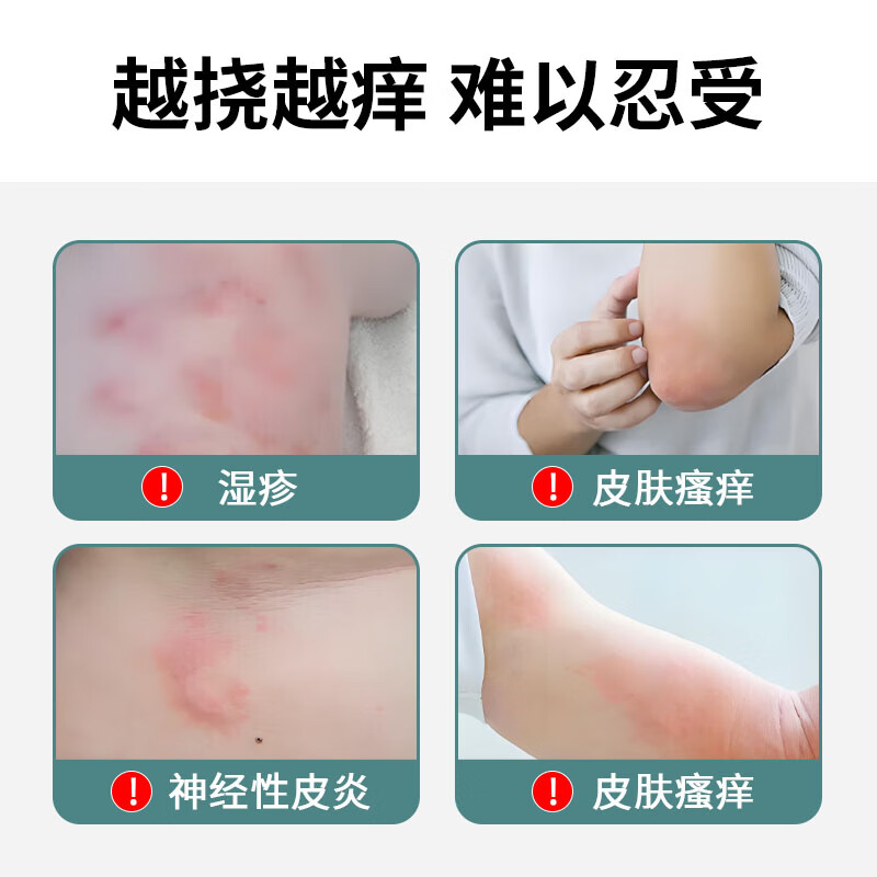 元氏立元堂草本抑菌小乳膏皮肤瘙痒皮炎湿疹体癣真菌感染皮肤外用止痒软膏 1盒 京东物流次日达·送货上门·正品保障·当日发货