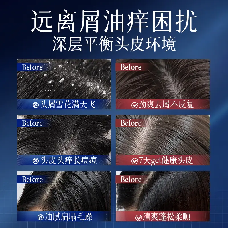 SOCUS二硫化硒洗发水去屑止痒控油持久蓬松深层清洁洗头膏露男女士专用 【持久蓬松】控油去屑二硫化硒洗发水 800ml*1瓶