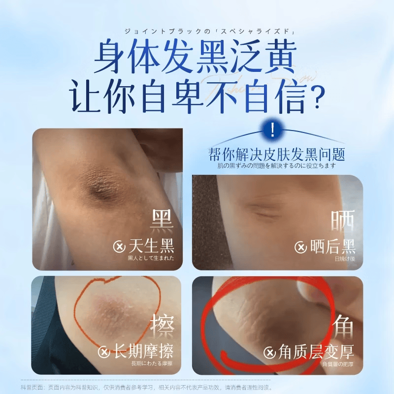 葵花胳膊肘黑色素沉淀去除手肘快速去黑淡化胳膊肘黑色素去黑去皮角质 【三盒】一抹转白