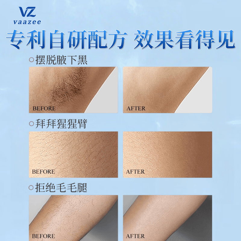 VAAZEE德国专研脱毛膏女士专用私密处腋下腿毛青少年男士胡子男女士通用 单支装【临时应急】0痛感0黑点 脱毛膏非永久去艮不再生长医用脱毛京棟自蓥部分次日达