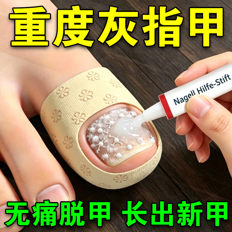 L0【德国进口】灰指甲笔抑菌液去灰指甲甲增厚专用修复指甲护理正品 【重度疗程】灰指甲笔*3.