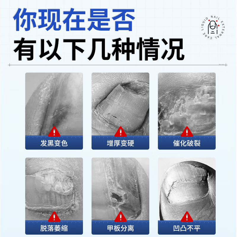港村制药身体护理指甲护理液滋润甲周强韧软薄易断甲改善暗沉亮泽 1盒[基础装】