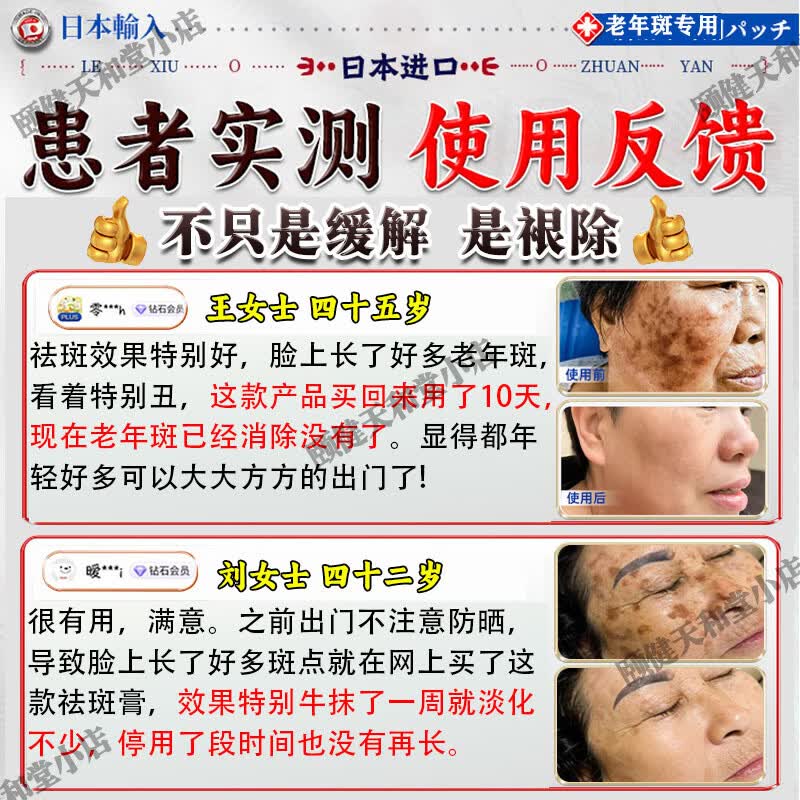 藤川岗田祛斑霜老年斑专用一夜消去黄褐雀斑晒斑女士用的脸部手背医用正品 特效:一盒装【日本进口一夜消】 白美淡化祛斑去黑色素黄褐雀斑晒斑男女士用的特效非药