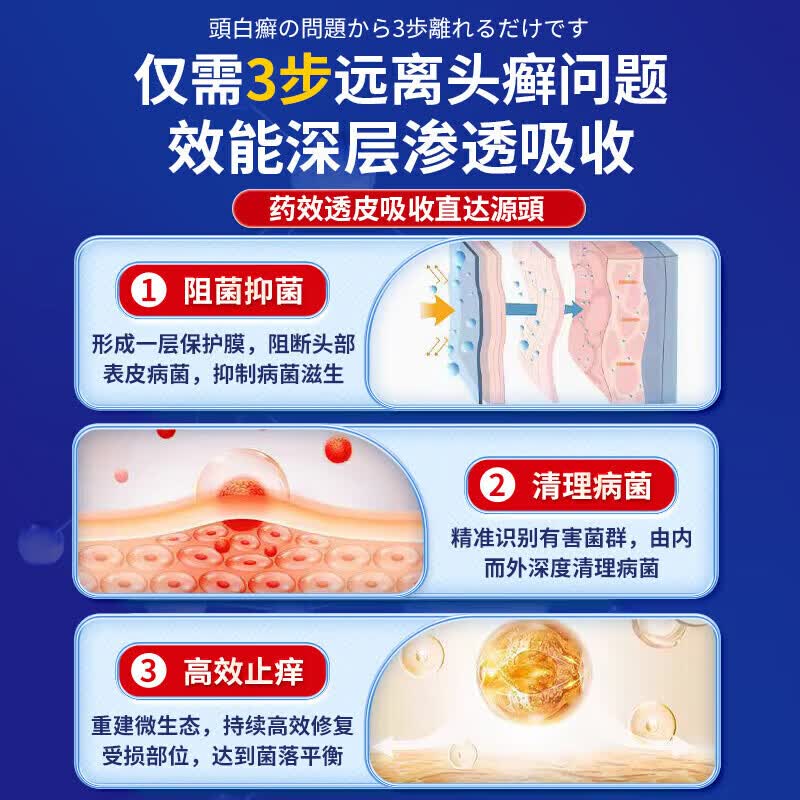 久研制药头癣头皮癣专用效喷剂真菌感染头皮屑瘙痒牛皮癣银屑病100%效去跟 药剂【100%根断】一瓶