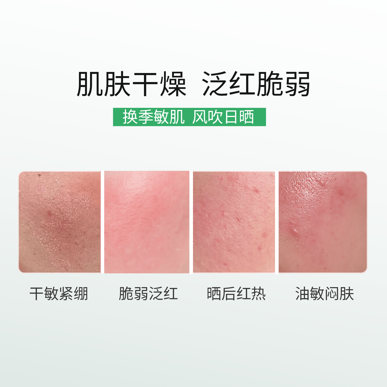 自然攻略依克多因舒敏修护面膜 敏感肌改善泛红补水保湿修护屏障 1盒