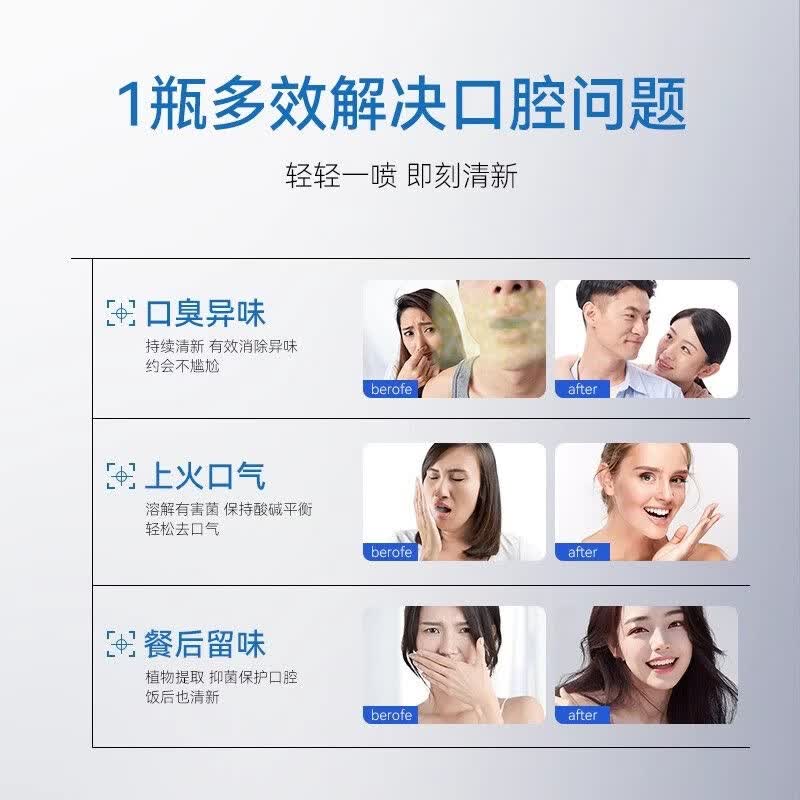 SAYMEET口腔清新喷剂抑菌口臭持久清新口气植物提取男女便携口喷 30ml一瓶【优惠装】