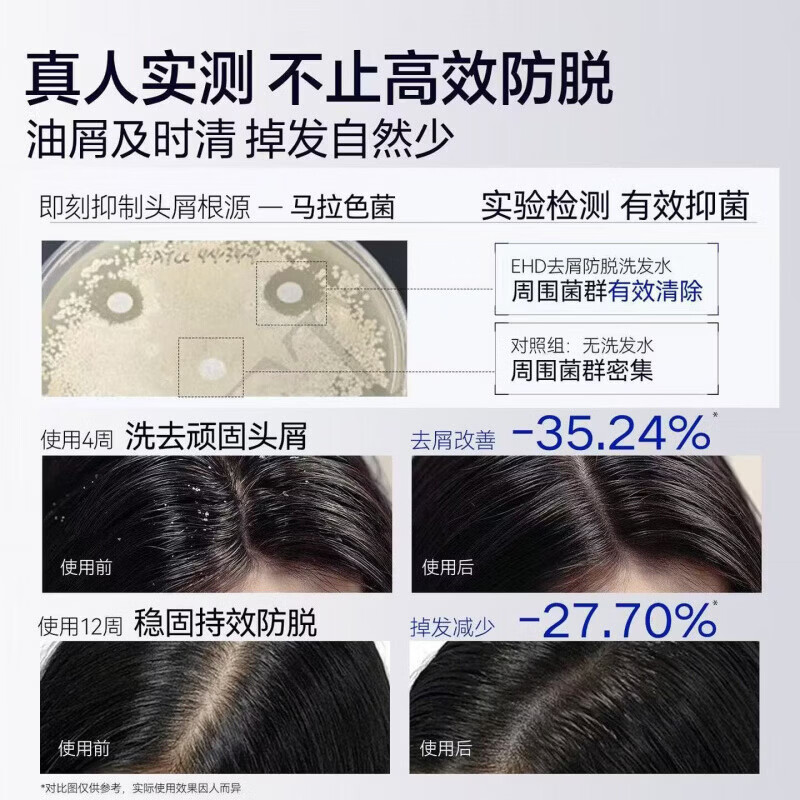 源生堂防脱育发洗发露何首乌当归植物本草菁萃五养养发控油蓬松正品 2瓶【倍速育发 发量+90%】 【官方旗舰 京质保障】