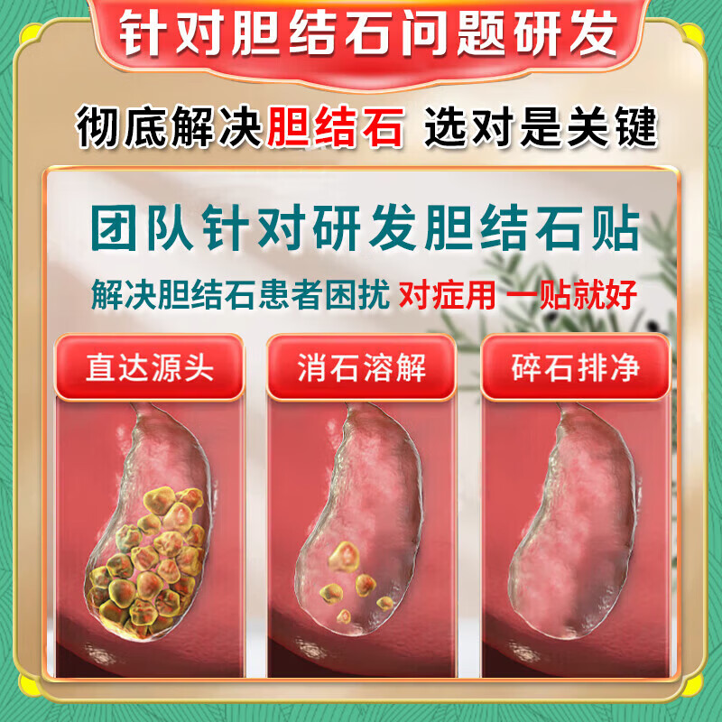胆结石100%药排石药胆结石贴德国消石贴专用胆囊结石专用的药进口 特效【贴上不痛】三盒