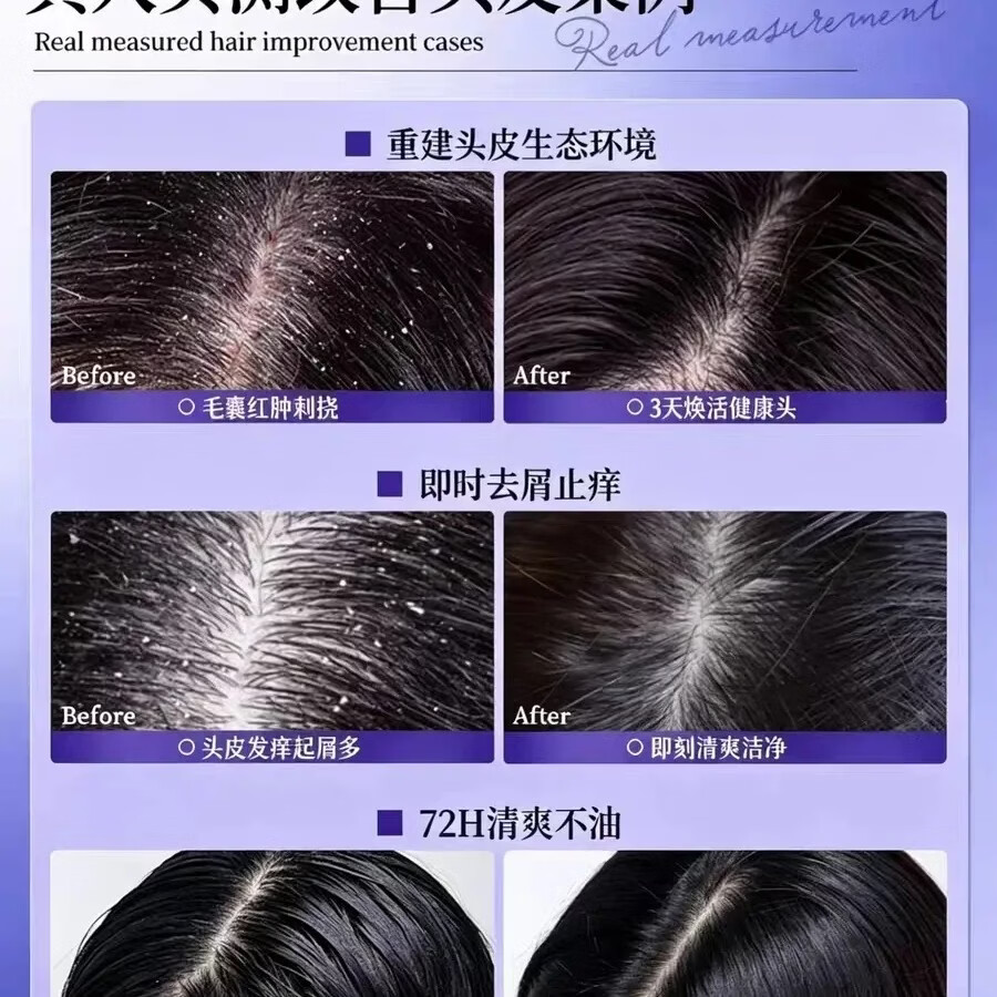 C7二硫化硒去屑洗发露 控油止痒改善头屑 清爽头皮男女家用洗发水 一瓶300g