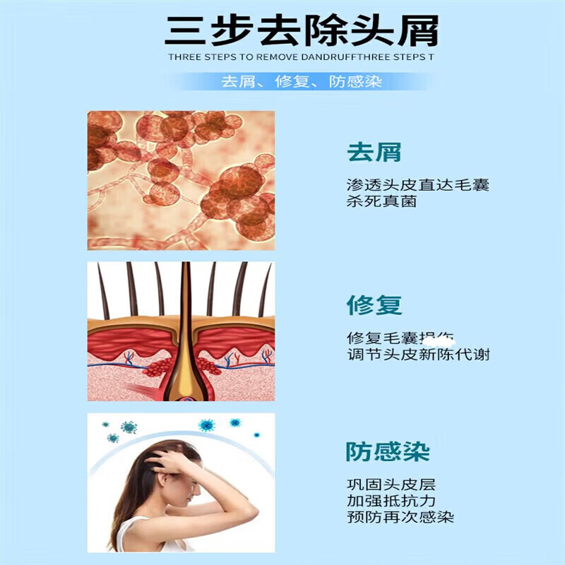 康王洗发i水去屑止痒皮炎毛囊炎脂溢性皮炎湿疹皮癣真菌感染 1盒 体验装