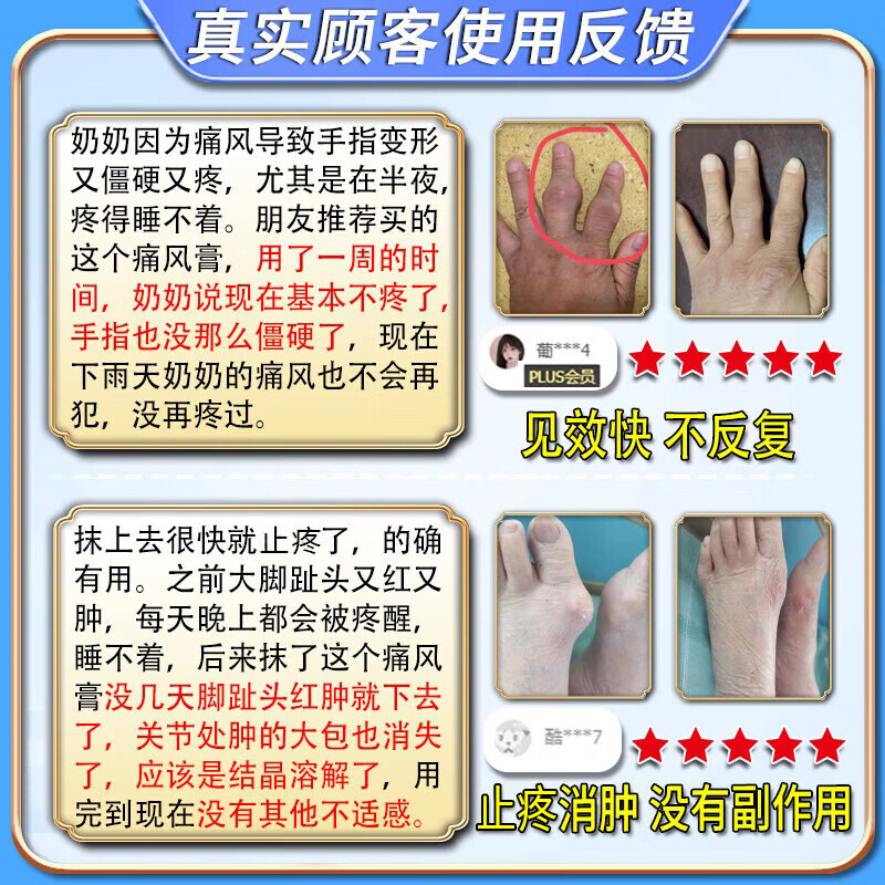 岩井昃弘痛风结晶溶解药去除痛风石膏药贴降i尿酸消肿止痛尿酸高关节疼痛 特效3盒膏【200%治根】日本进口 特效新i版专用膏强力结晶进口