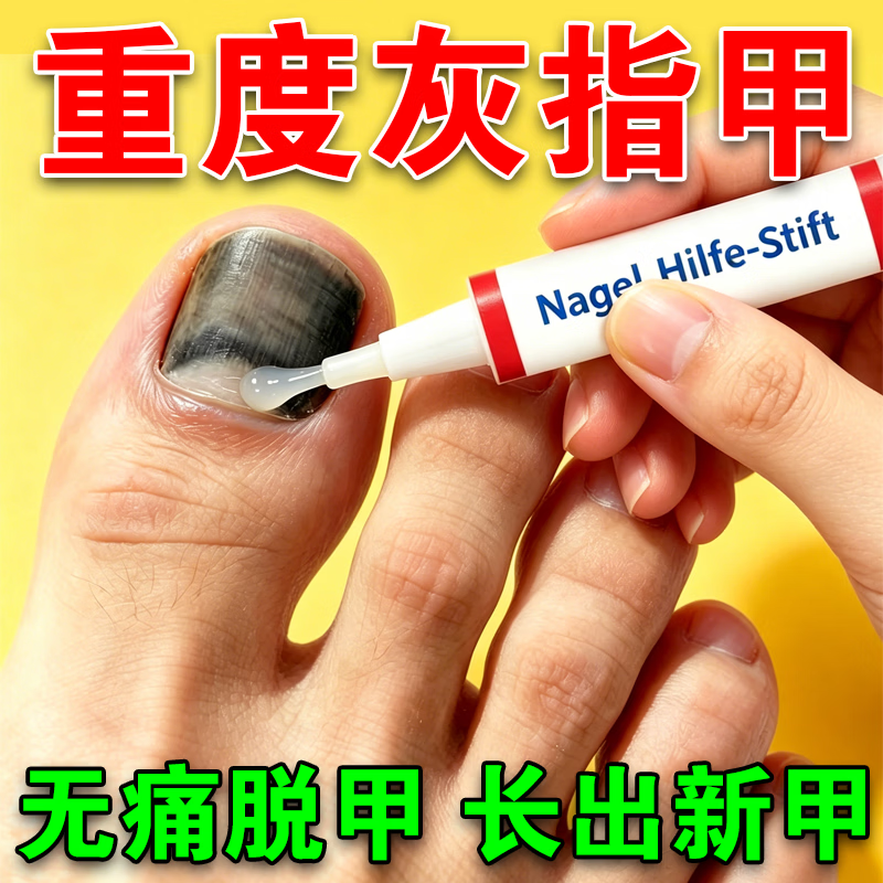L0【德国进口】灰指甲笔抑菌液去灰指甲甲增厚专用修复指甲护理正品 【重度疗程】灰指甲笔*3.