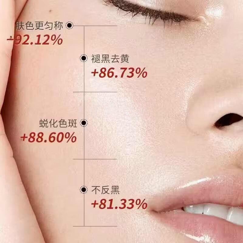 思丽安乳膏壬二酸20%祛痘凝胶去粉刺闭口淡化痘印玫瑰痤疮软霜膏 买3送2【5盒】巩固装