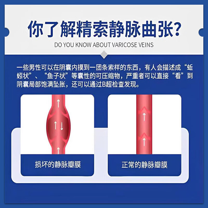 日本新薬株式会社精索静脉曲张专用进口药冷敷凝胶男性左侧睾丸疼痛胀喷雾内裤拖带 5瓶【周期装】建议中度患者