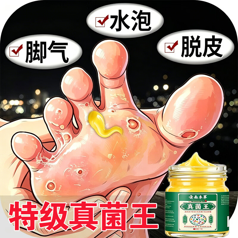 真菌王手足感染癣脚气止痒脱皮烂脚丫云肤用抗藥南抑菌膏 2瓶装真菌王【中度止痒】