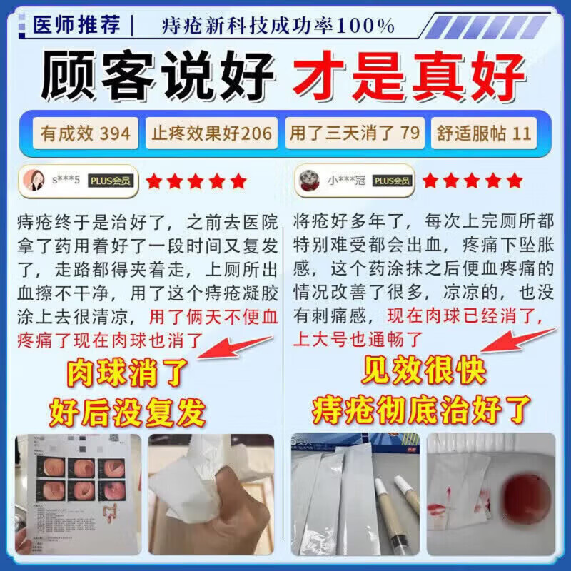 优朵花凝胶敷料有朵花忧多话内外混合痔肛裂瘙痒便血膏 1支【体验发正装】周期效果更佳 【官方直售 京质保障】