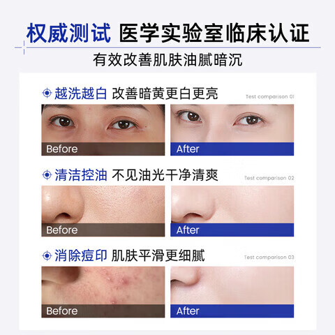 韩伦美羽取青洁面乳青蒿敏肌舒洁面乳面部清洁保湿顺润净肤温和洁净平衡 5支装 买三送二【囤货装】 【官方直售 京质保障】