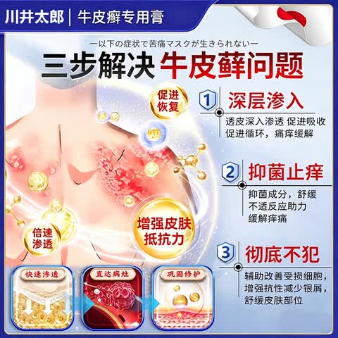 卫莱恩铜片白癜风日本进口膏白斑花斑汗斑快速消退外用遮盖神器官方正品 1盒装【体验发正装】 【官方直售 京质保障】