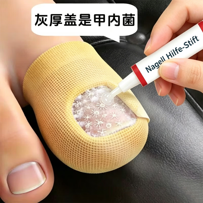 L0【德国进口】灰指甲笔抑菌液去灰指甲甲增厚专用修复指甲护理正品 【重度疗程】灰指甲笔*3.