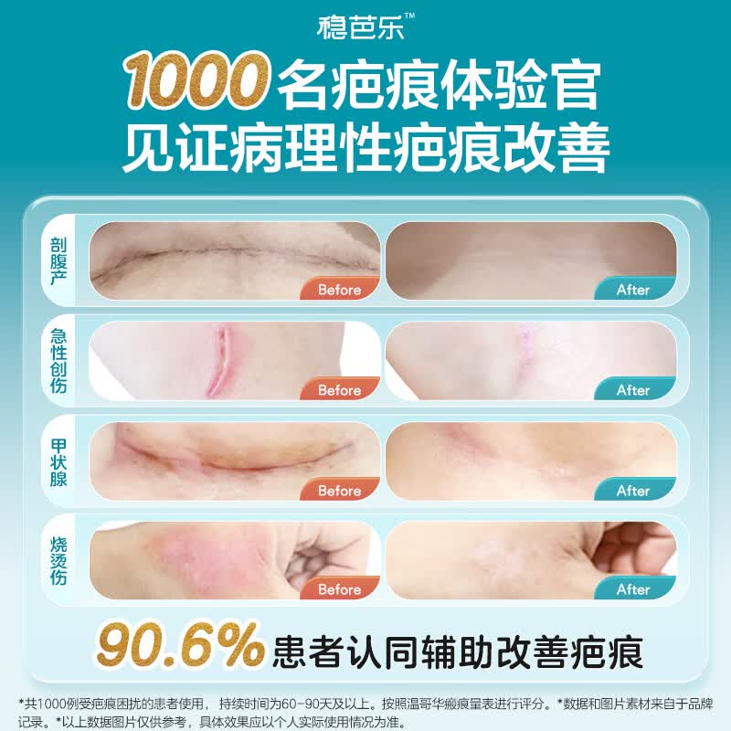 稳健医用硅酮疤痕凝胶硅凝胶去疤痕膏祛疤痕专用修复儿童剖腹产手术 【下单送10g】硅酮疤痕凝胶Ⅱ型12g/支