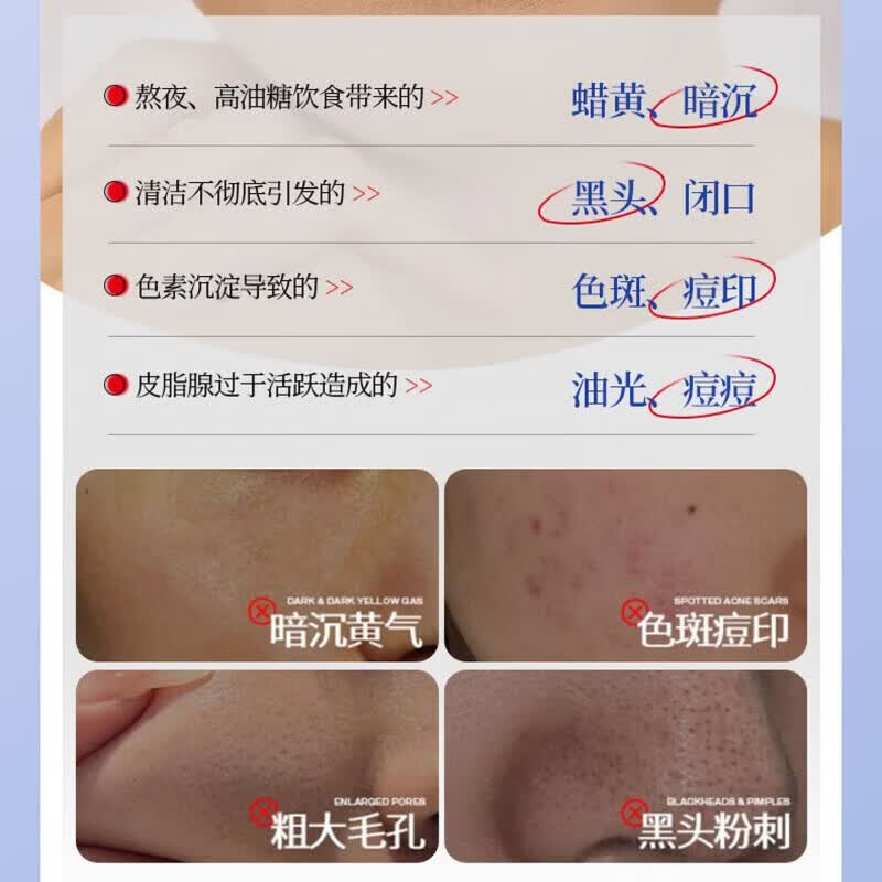 秋雁容洗面奶氨基酸美白提亮肤色控油祛痘收缩毛孔温和不刺激清洁不拔干 5瓶 买三赠二【囤货装】 【全新配方 新品上市】