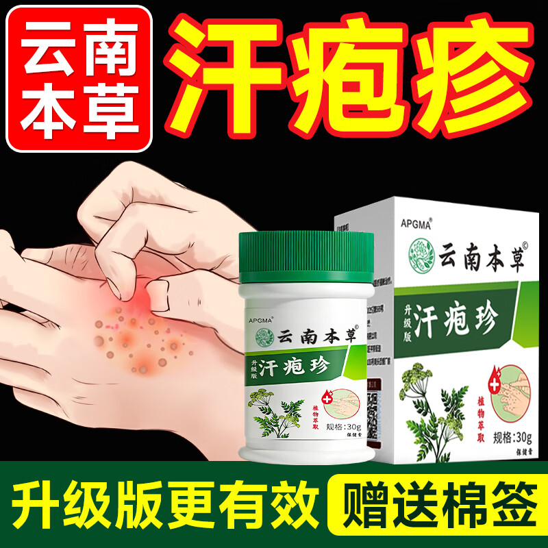 云南本草汗疱疹药膏手上痒起小水泡汗疱疹湿疹止痒手起水泡痒脱皮干药膏 1盒试用装