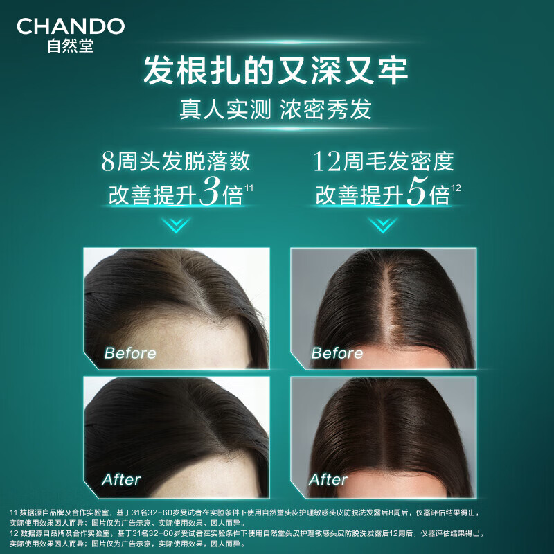自然堂(CHANDO)控油止痒柔顺保湿 【实惠装】防脱洗发露550ml+补充装500ml+100ml*2