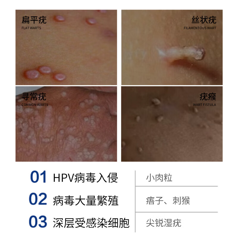 斯诺舟炉甘石软膏婴儿抑菌止痒膏湿热疹大人宝宝通用倍护舒缓膏洗剂 去尤专用膏2支