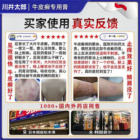 卫莱恩铜片白癜风日本进口膏白斑花斑汗斑快速消退外用遮盖神器官方正品 1盒装【体验发正装】 【官方直售 京质保障】