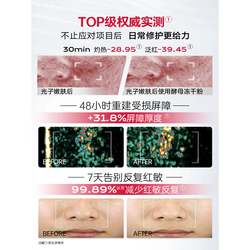 优理氏酵母修护冻干粉褪红舒缓保湿 修护敏感肌肤屏障受损护肤品礼物 【褪红舒缓】酵母冻干粉20支