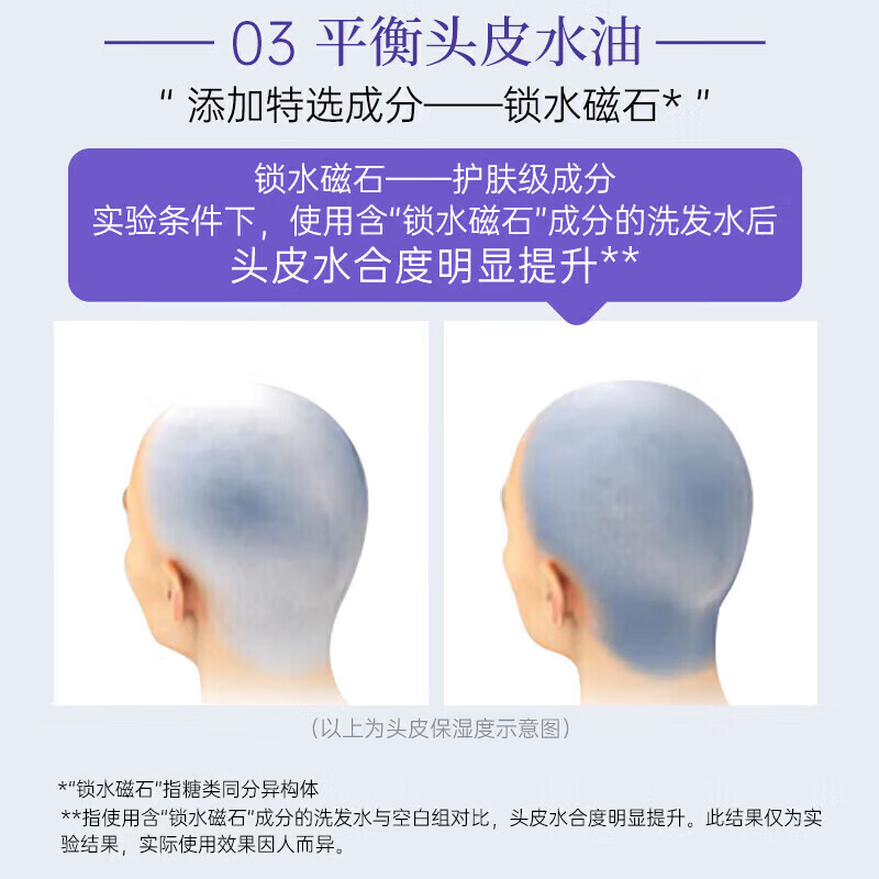 康王拜耳二硫化硒洗发水去屑止痒控油蓬松洗发露清爽柔顺洗头膏 去屑清爽+去屑蓬松各一瓶