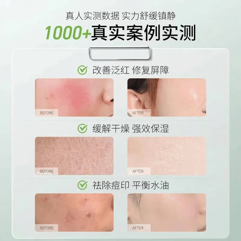 完美芦荟胶正品淡化疤痕家用修护补水祛痘保湿滋润修复凝胶 5支【分享装】20%用户选择