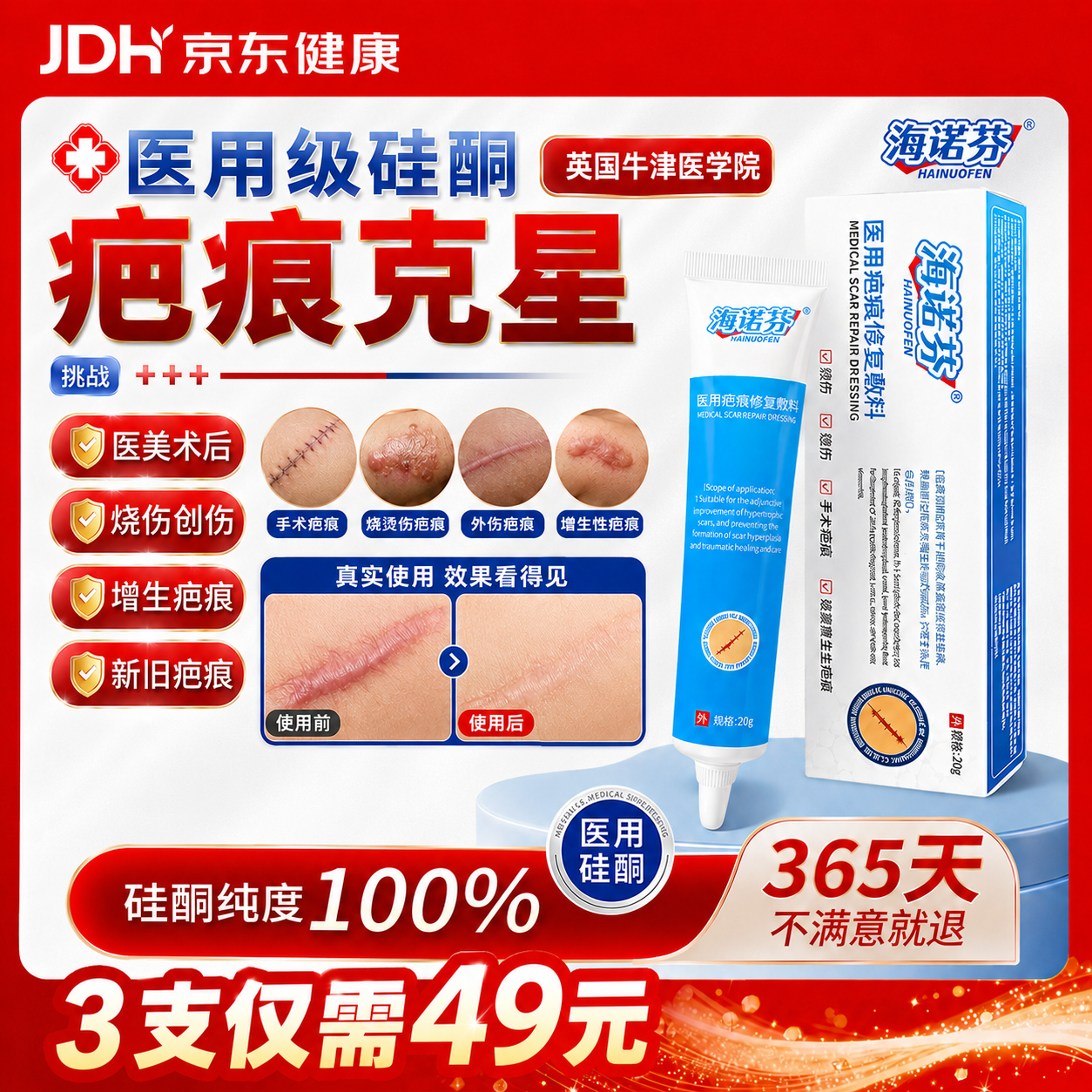 海诺芬祛疤膏修复改善疤痕医用硅酮凝胶医院专用剖腹产手术缝针