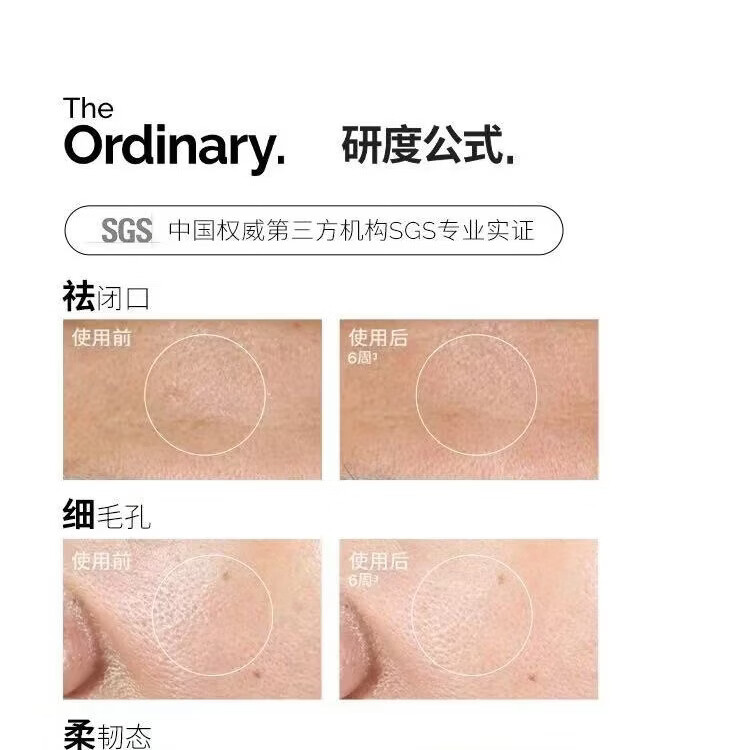 THE ORDINARY7%甘醇酸果酸水保湿精华爽肤水果酸祛痘温和研度公式去角质护肤品 THE ORDINARY 240ml果酸水*1瓶（提亮肤色 淡化痘印）