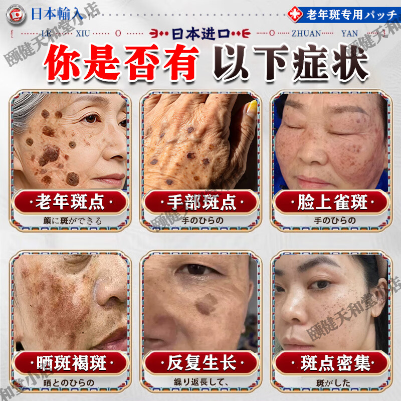 藤川岗田祛斑霜老年斑专用一夜消去黄褐雀斑晒斑女士用的脸部手背医用正品 特效:一盒装【日本进口一夜消】 白美淡化祛斑去黑色素黄褐雀斑晒斑男女士用的特效非药