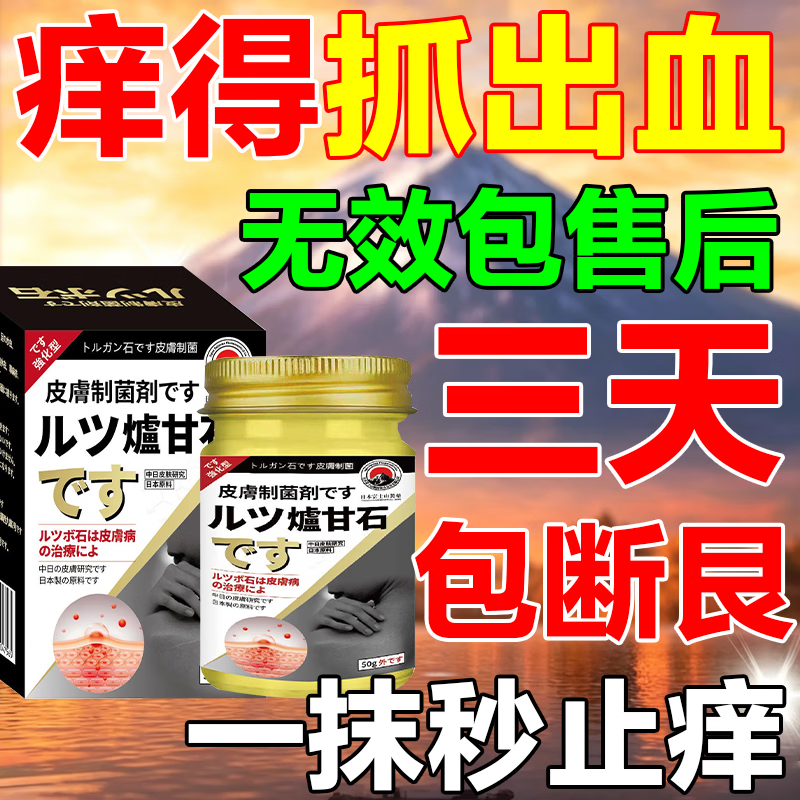 皮肤瘙痒止痒杀菌炉甘石膏皮焱湿诊真菌皮肤干燥瘙痒止痒断痒王 买2送1【3秒止痒】炉甘石膏