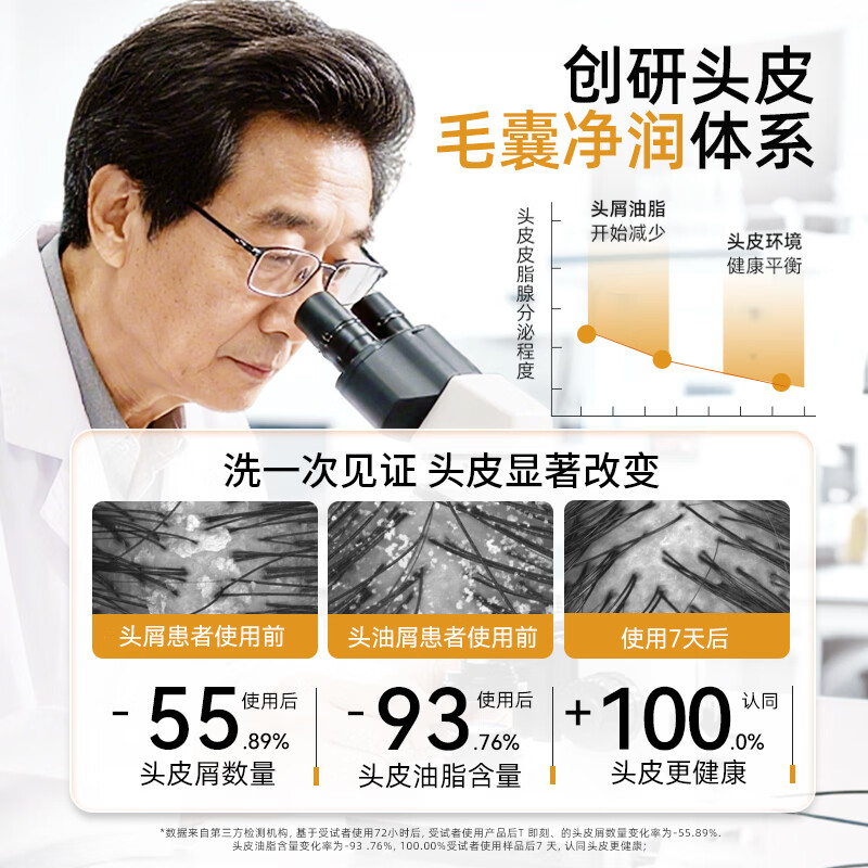 采乐二硫化硒洗发液去屑洗发水控油蓬松洗发膏官方正品 【日常头屑头痒】日常去屑 300ml*1瓶
