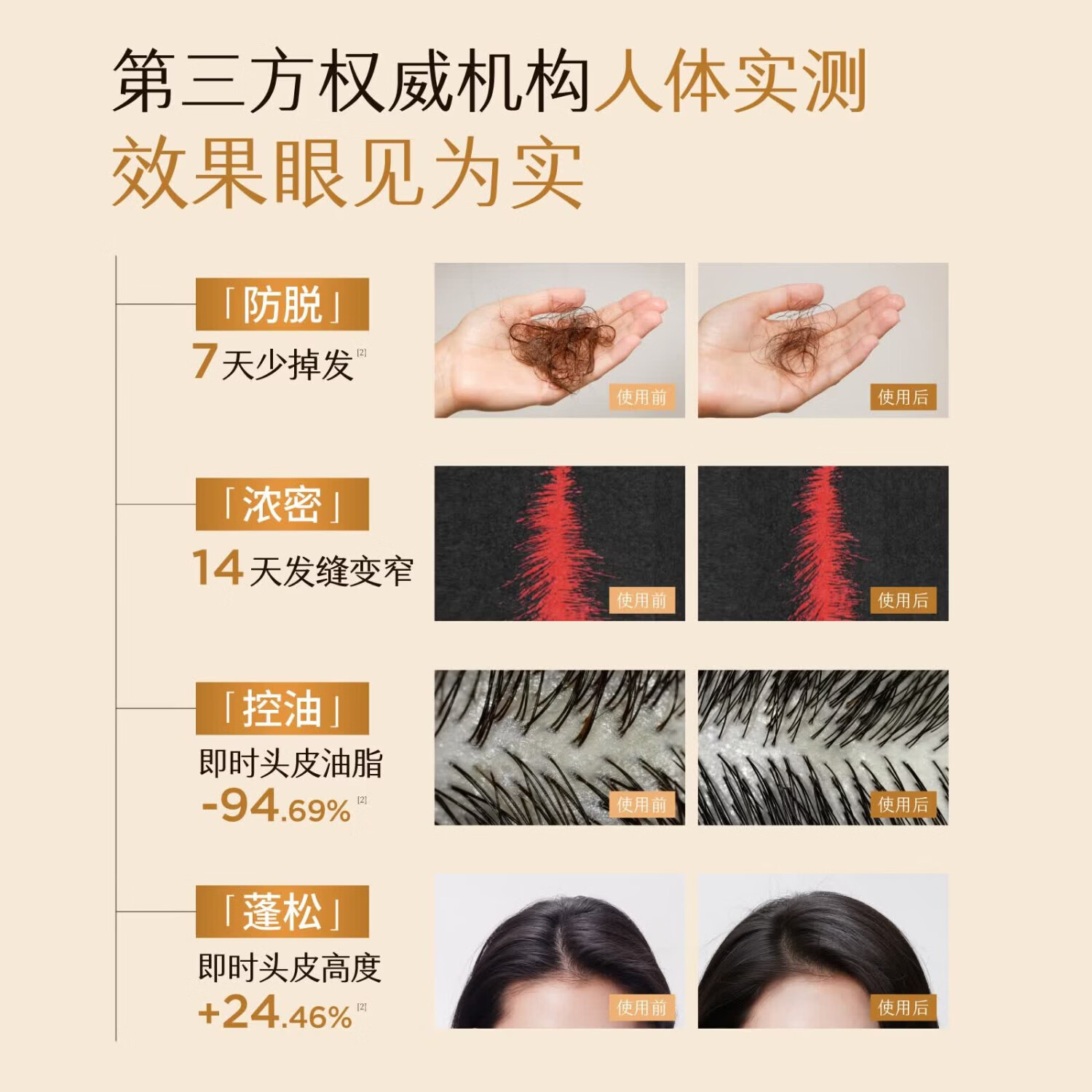 半亩花田（Little Dream Garden）防脱洗发水强韧固发控油蓬松洗发皂300g 【持证防脱】300g
