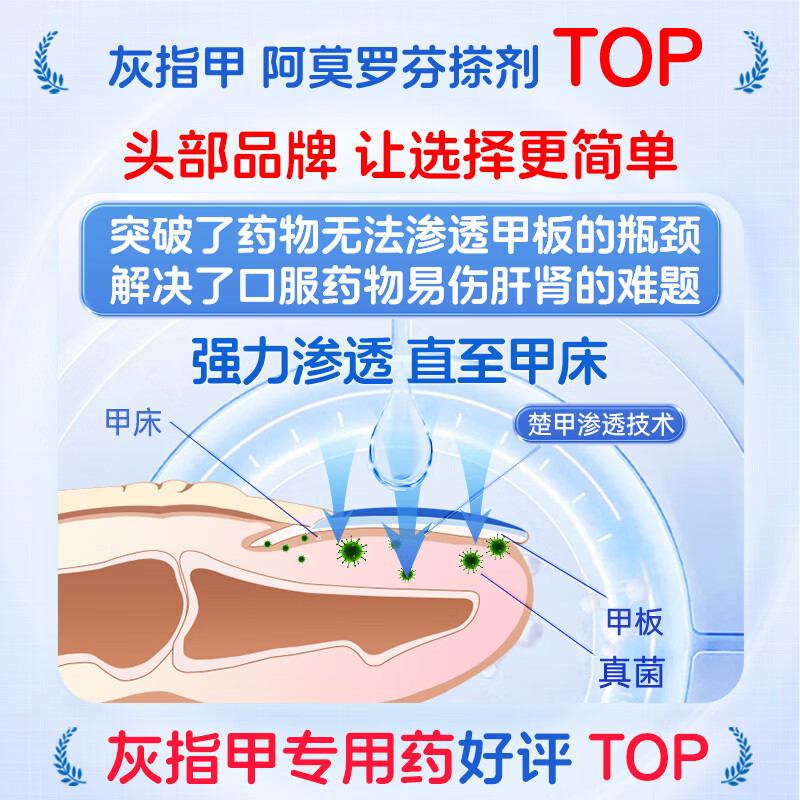 楚甲盐酸阿莫罗芬搽剂1.5ml国药准字治疗灰指甲专用药正品真菌感染皮肤用药抑菌阿莫罗芬搽剂正品旗