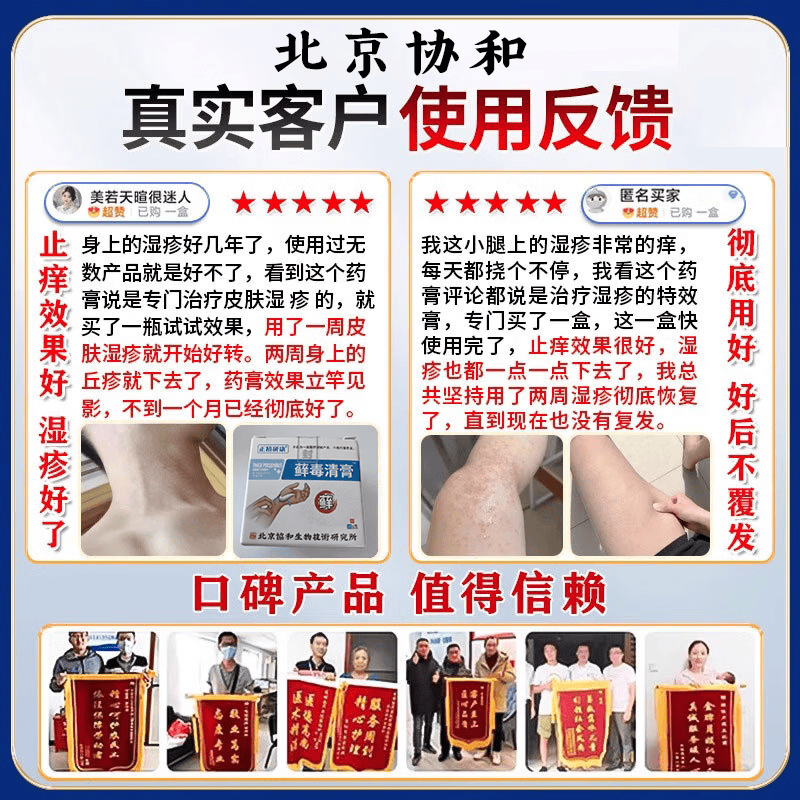 北京协和医学院日本进口湿疹药膏湿毒清皮肤瘙痒皮炎100%真菌王感染去止痒根专用 特效1盒【北京协和】柏可芬软膏湿疹药膏十大牌子 苗药顽固湿疹热疹皮癣婴儿抑菌止痒膏湿疹药膏十大牌子