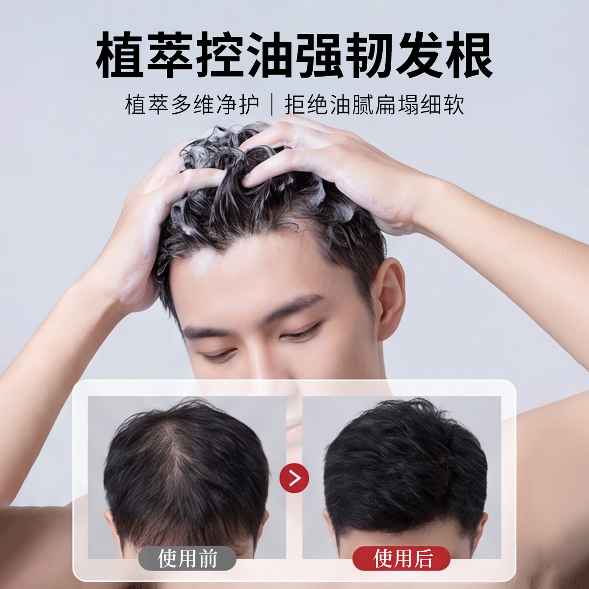 莉米洛LIMILUO莉米洛男士控油蓬松肽洗发水改善油腻扁塌蓬松清洁秀发 【二瓶】男士控油蓬松洗发水