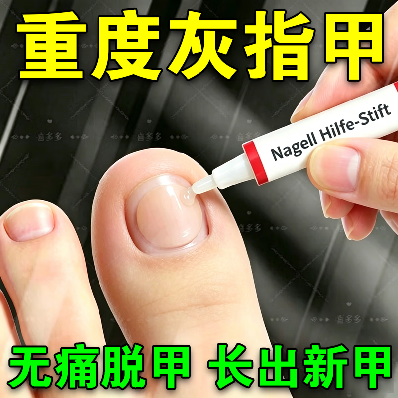 L0【德国进口】灰指甲笔抑菌液去灰指甲甲增厚专用修复指甲护理正品 【重度疗程】灰指甲笔*3.