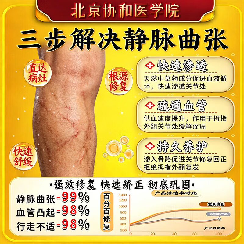 北京协和医学院静脉曲张专用膏药蚯蚓腿疏通血管堵塞进口药冷敷凝胶治疗静脉舒膏 特效1盒【专治曲张】北京协和 特效静脉曲张喷雾专用贴的