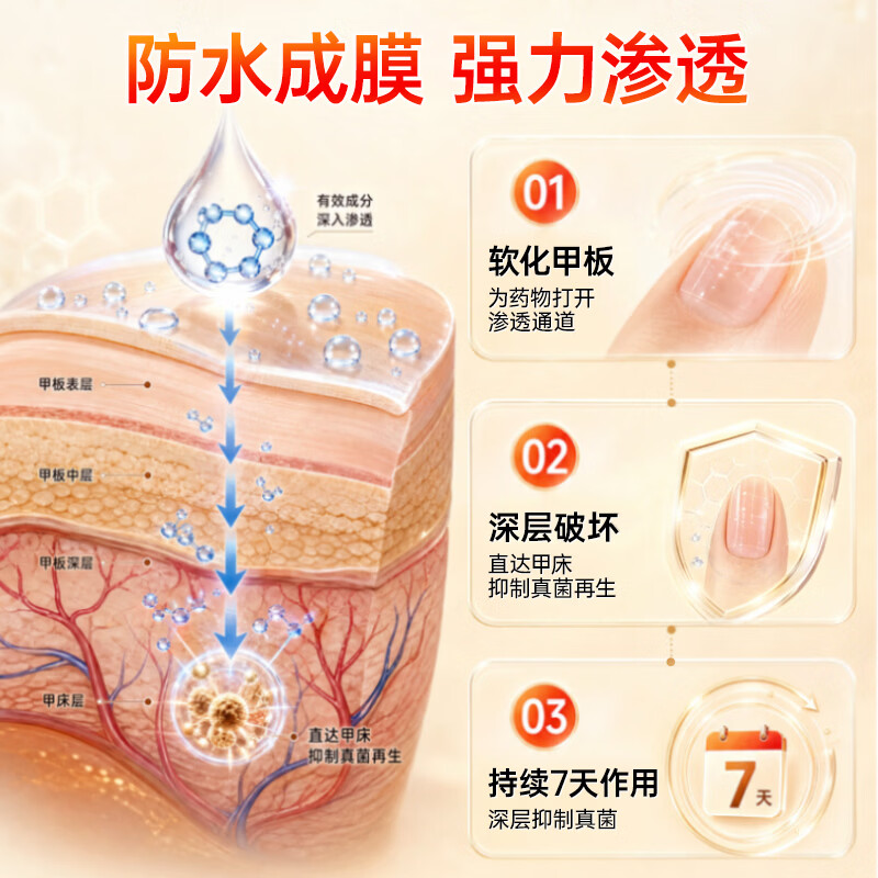 [时景]盐酸阿莫罗芬搽剂 5%*2.5ml 1盒装 阿莫罗芬搽剂灰指甲专用灰指甲盐酸阿莫罗芬搽剂盐酸阿莫罗芬乳膏